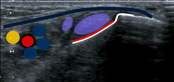 

Medial retromalleolar ultrasound anatomy

